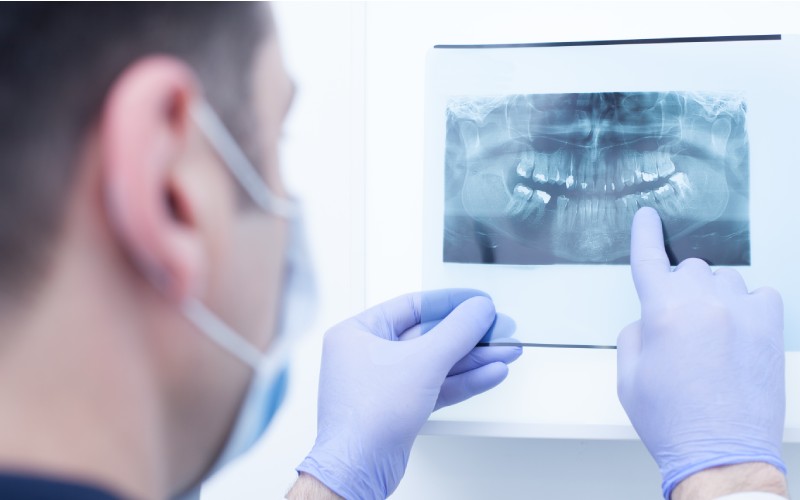male doctor looking at dental x ray