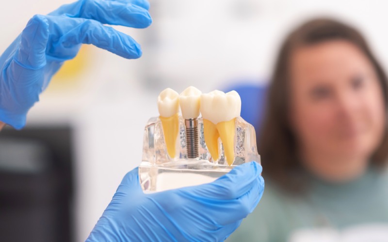 close dental model implant patient dental clinic blurred background dentistry